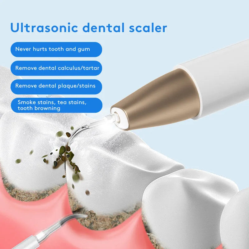 Gold ultrasonic tooth cleaning device for removing tartar and surface stains at home.