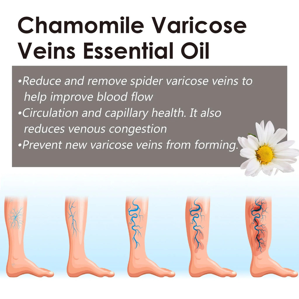 Chamomile leg essential oil bottle with 10ml net content for skin care and discomfort relief