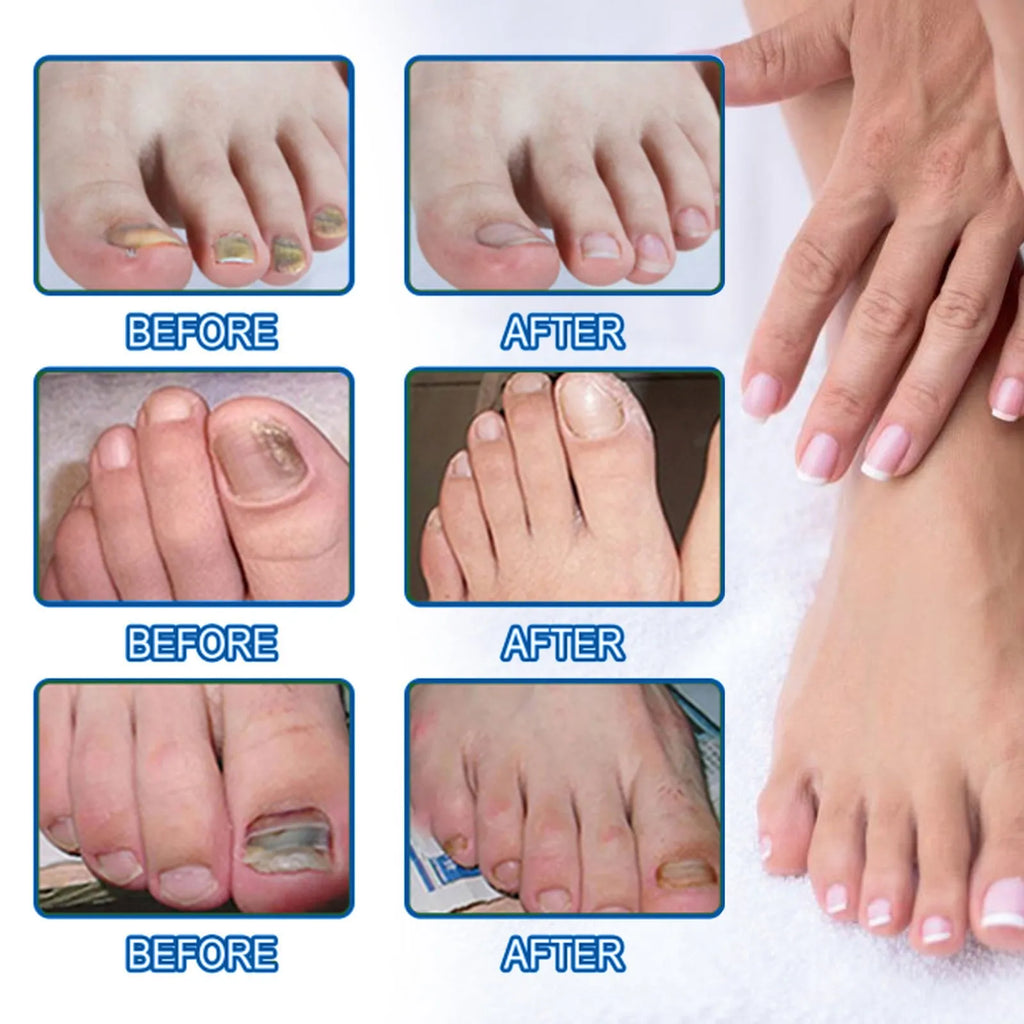 Nail nursing adhesive bandage repair stickers with natural ingredients in box of 32 patches
