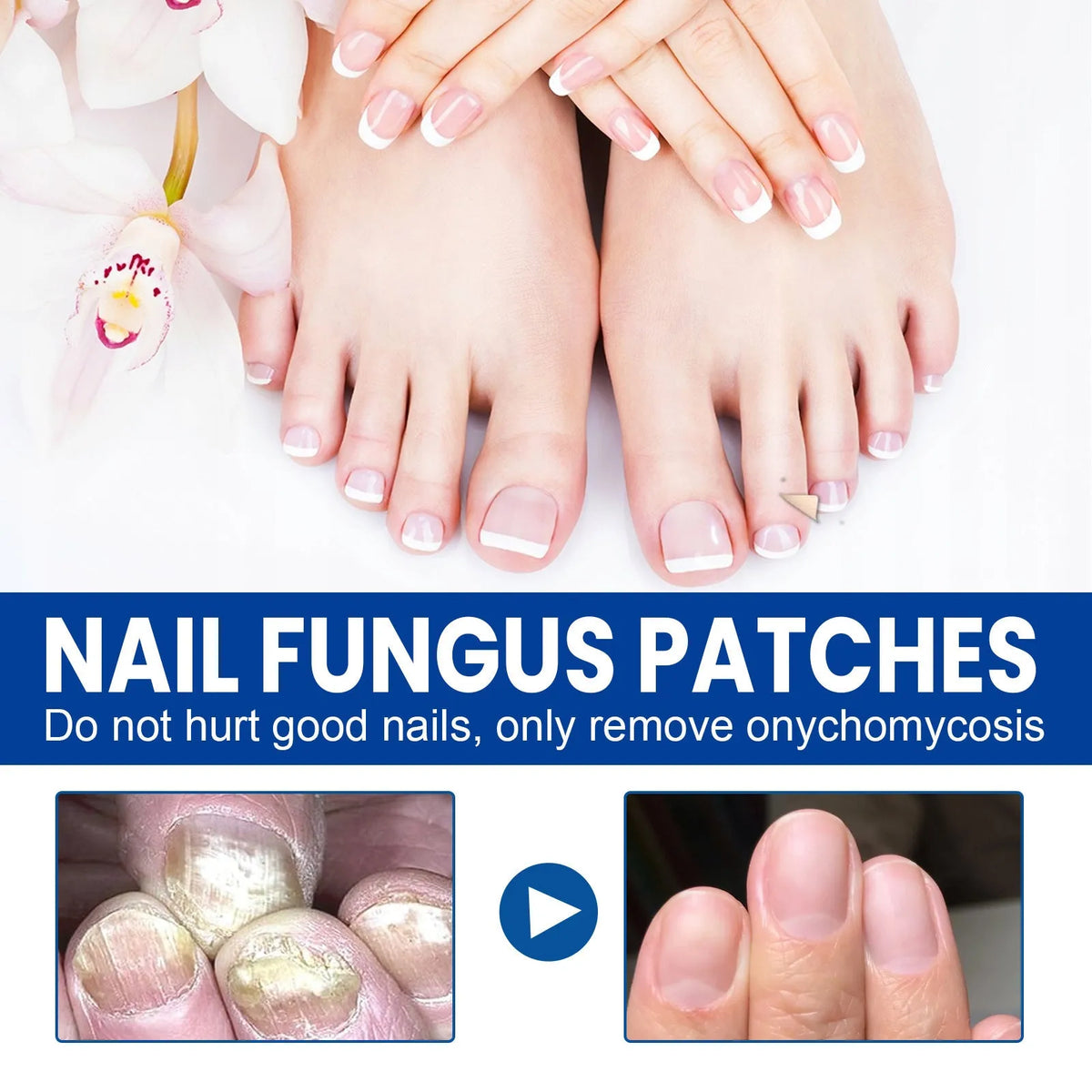 Nail nursing adhesive bandage repair stickers with natural ingredients in box of 32 patches