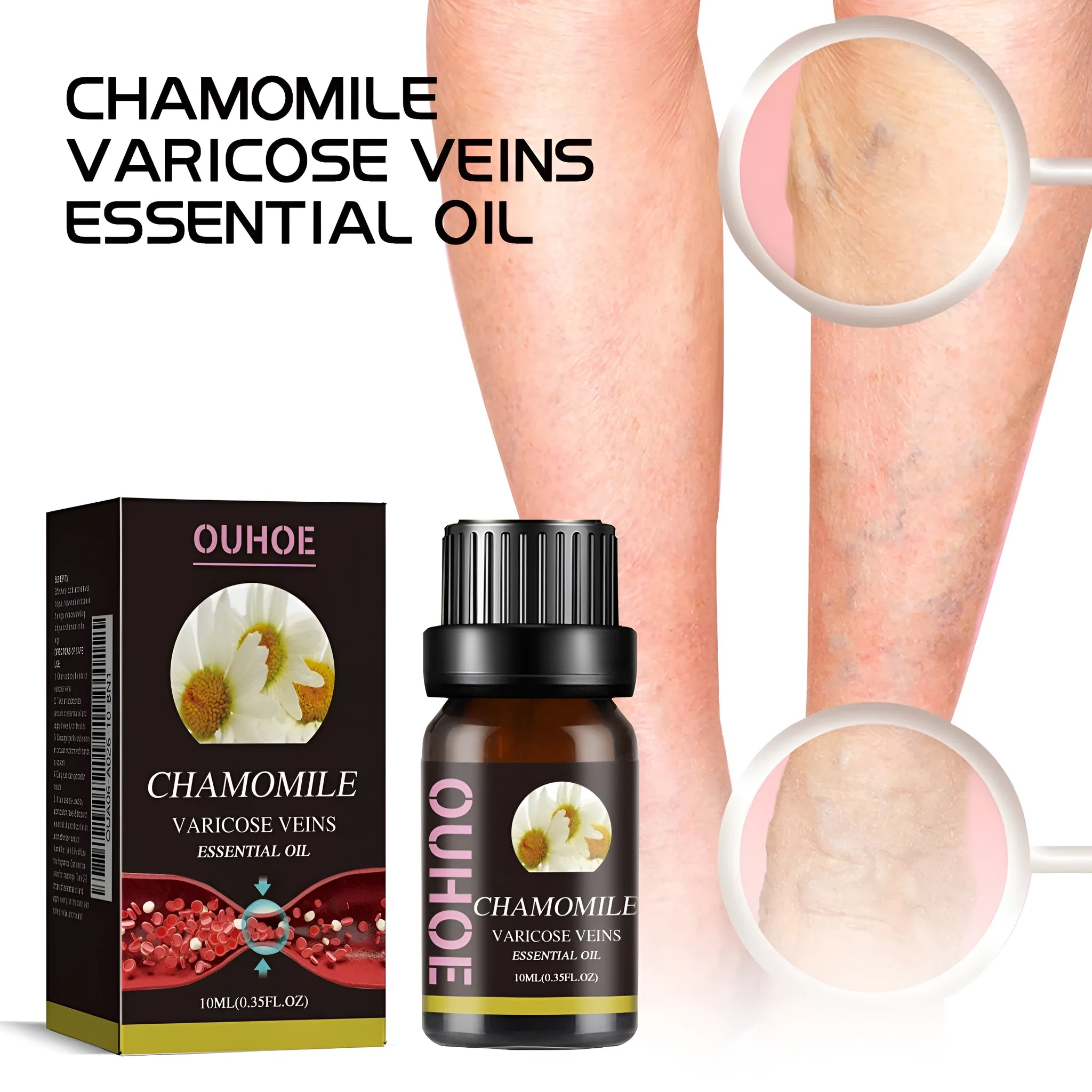 Chamomile leg essential oil bottle with 10ml net content for skin care and discomfort relief