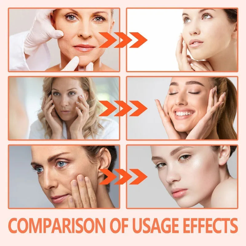 30ml bottle of rose essential oil for facial moisturising and fine wrinkle reduction.