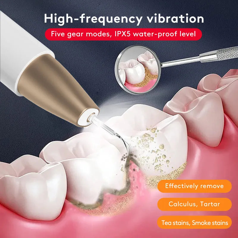 Gold ultrasonic tooth cleaning device for removing tartar and surface stains at home.