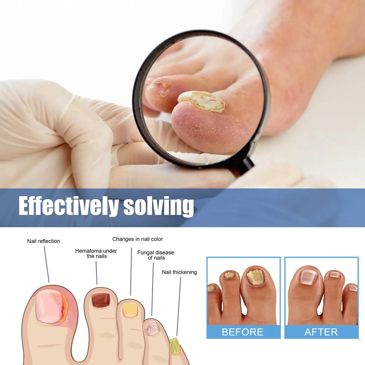 Nail nursing adhesive bandage repair stickers with natural ingredients in box of 32 patches