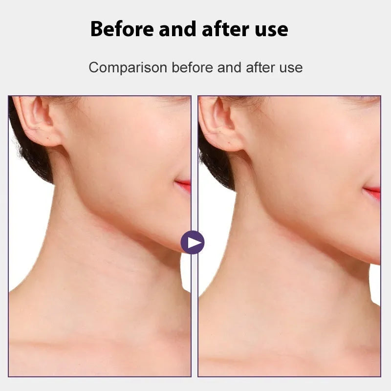 Skin tone neck firming adhesive tape sling with four straps and a pack of twenty patches.