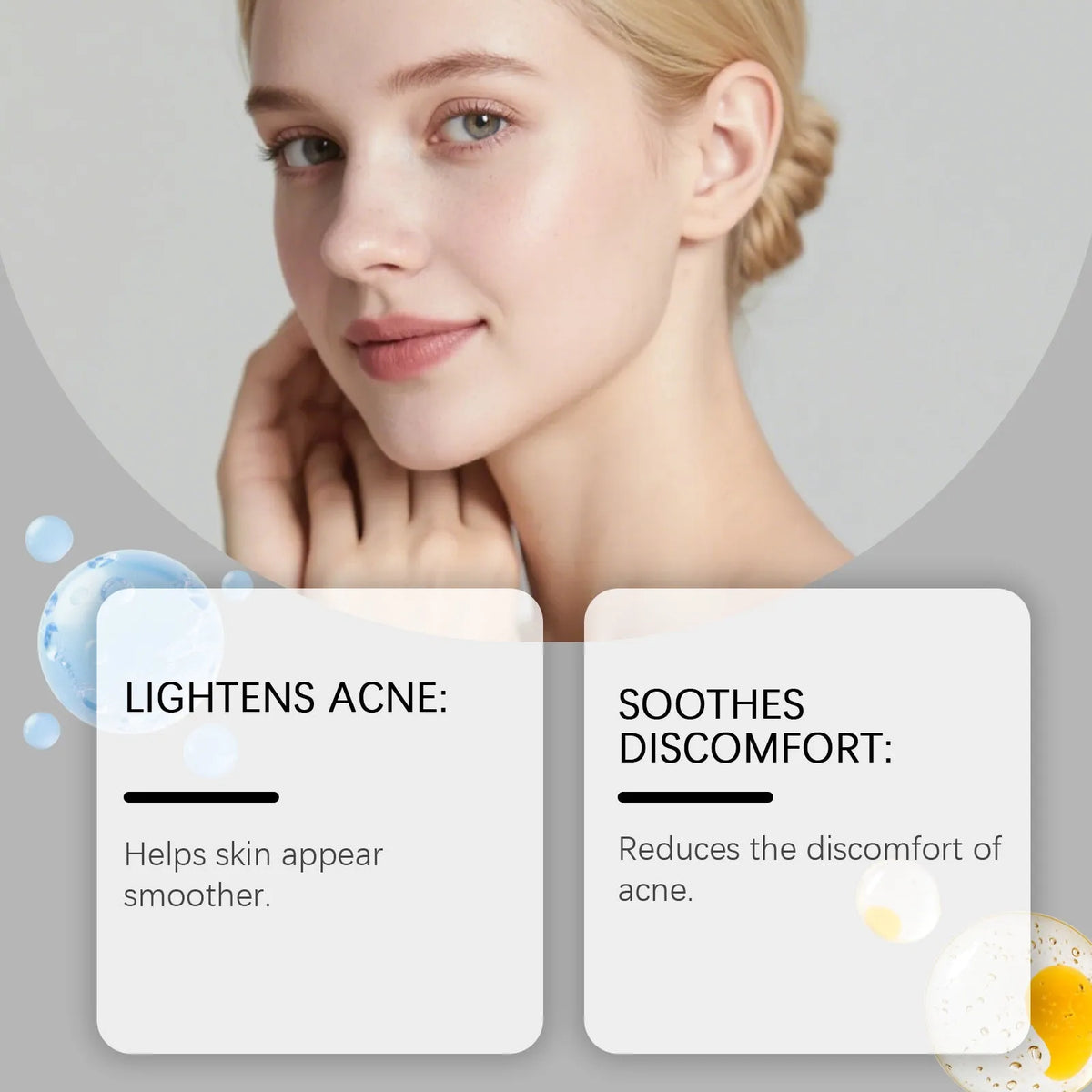 Package of 80 hydrocolloid facial acne patches for gentle spot treatment