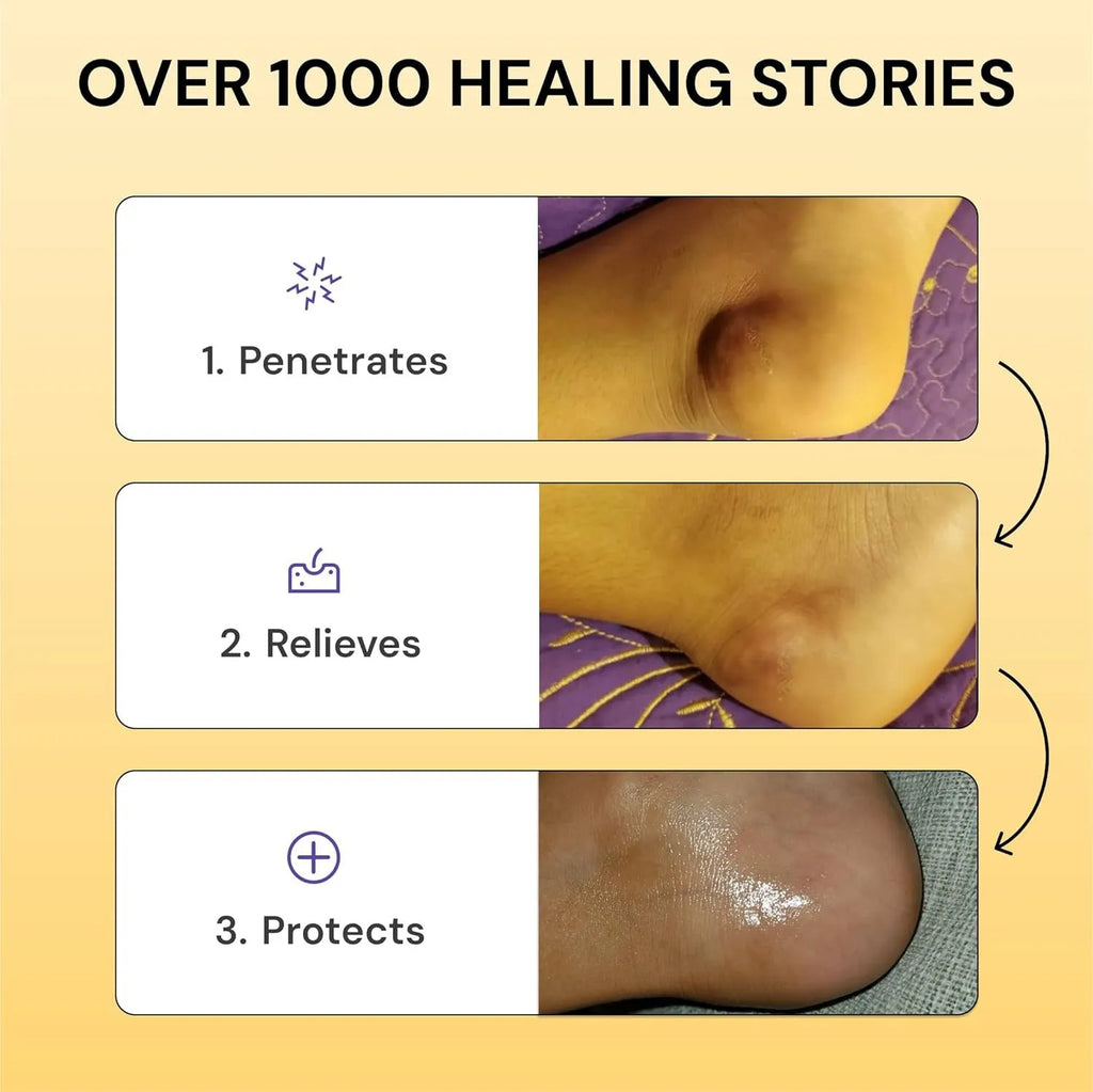 120g tube of Universal Flare Care muscle and joint pain relief cream with no-logo packaging