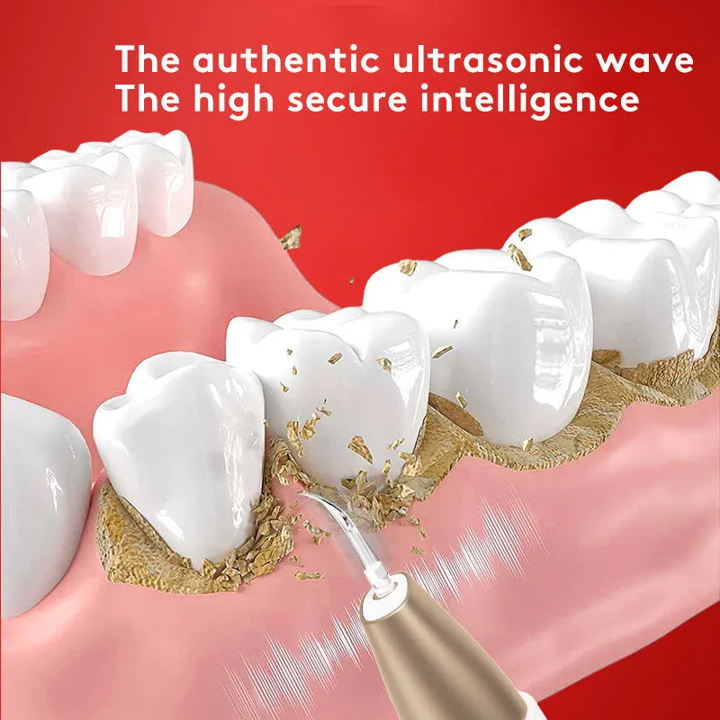 Gold ultrasonic tooth cleaning device for removing tartar and surface stains at home.